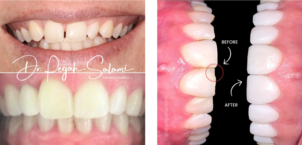 Cosmetic Dental Care