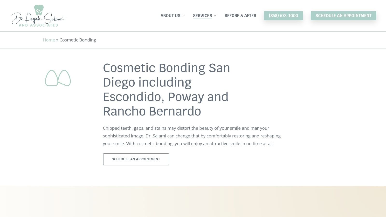 Cosmetic Bonding – San Diego