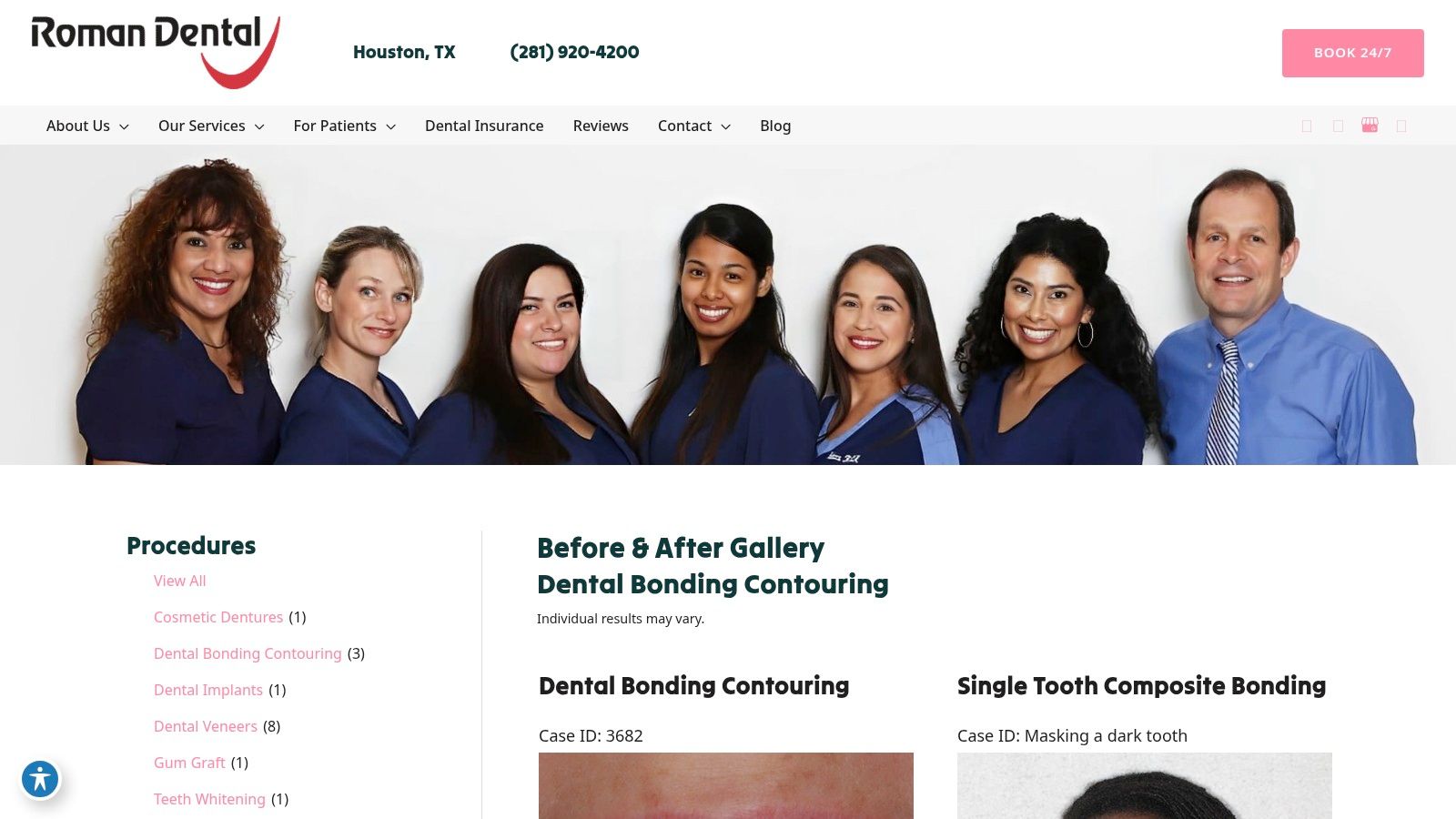 Roman Dental (Dental Bonding & Contouring Gallery)