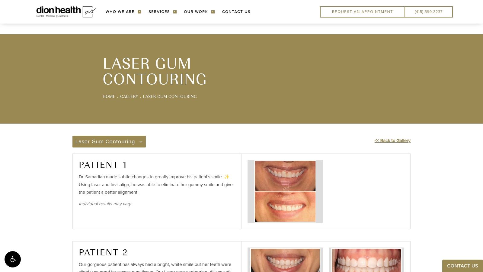 Samadian Cosmetic & Advanced Dentistry (Laser Gum Contouring)