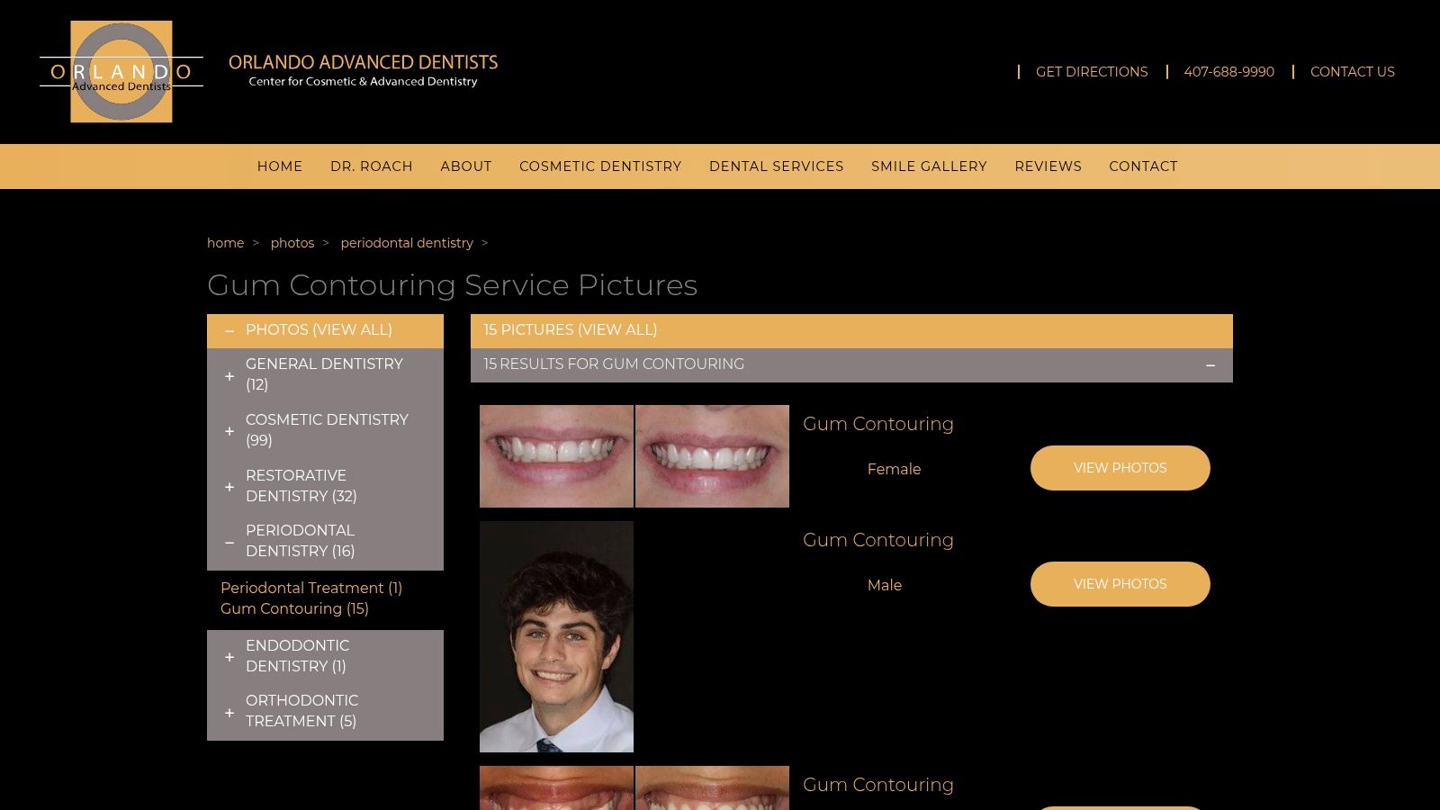 Orlando Advanced Dentists (Gum Contouring Gallery)